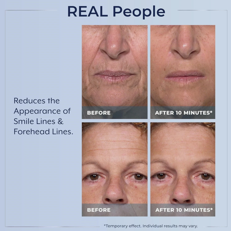 Plexaderm Rapid Reduction Serum 10ml | Instant Under-Eye Bag & Wrinkle Reducer  Product Title